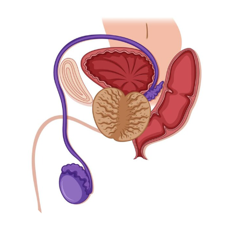 Prostate Hyperplasia 前列腺